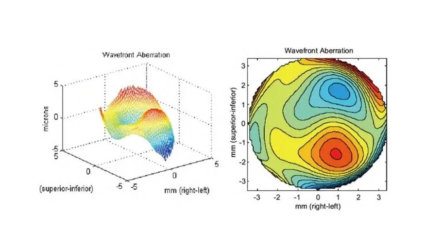 波前像差(波阵面像差)的基本知识 波前像差(波阵面像差)的基本知识