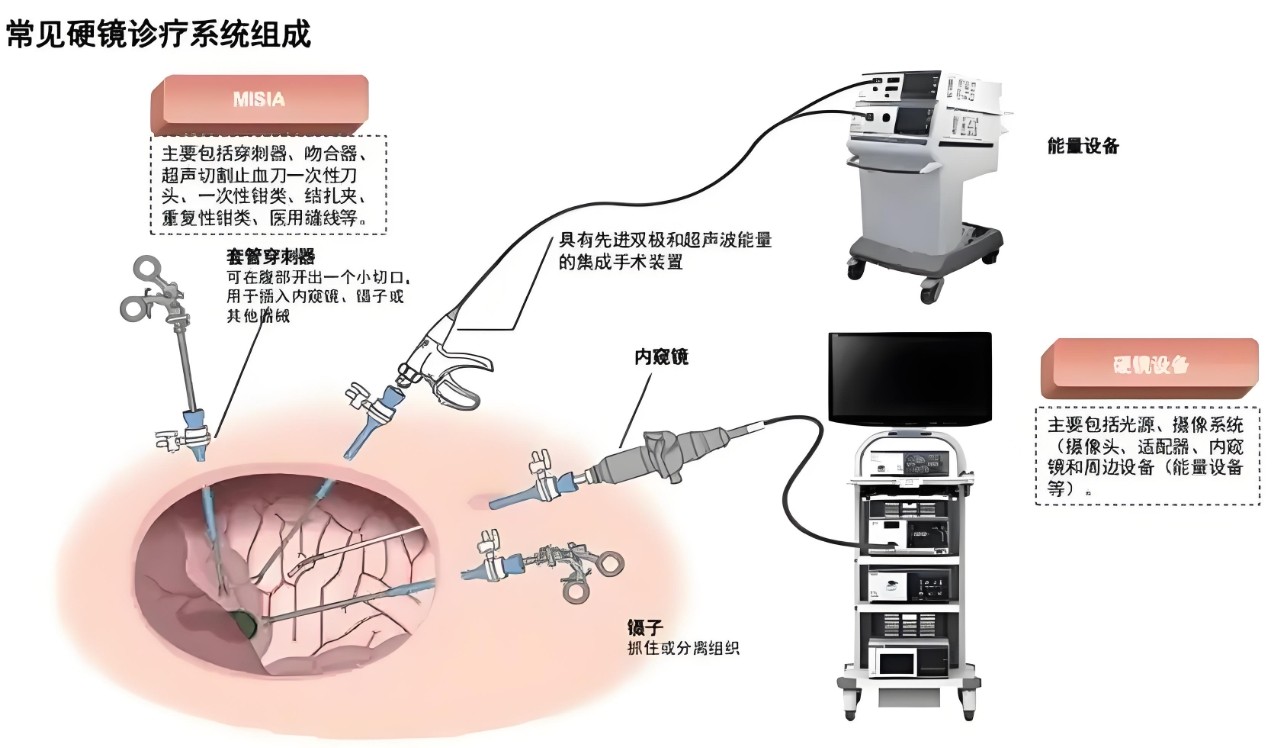 常见硬镜诊疗系统组成