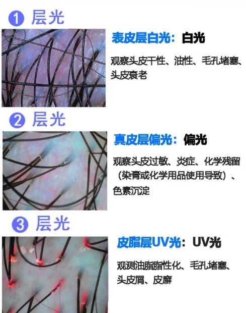 不同光对头发的观测效果 不同光对头发的观测效果
