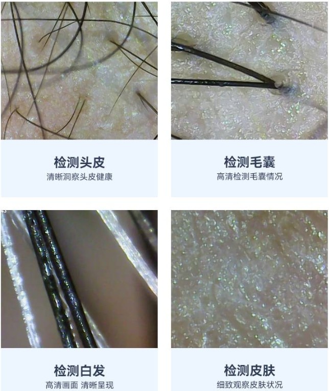 头皮检测仪的功能效果 头皮检测仪的功能效果