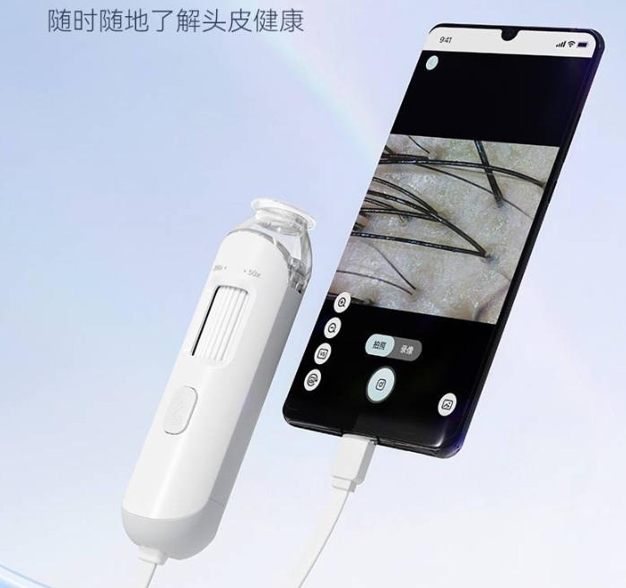 头皮检测仪链接手机查看效果 头皮检测仪链接手机查看效果