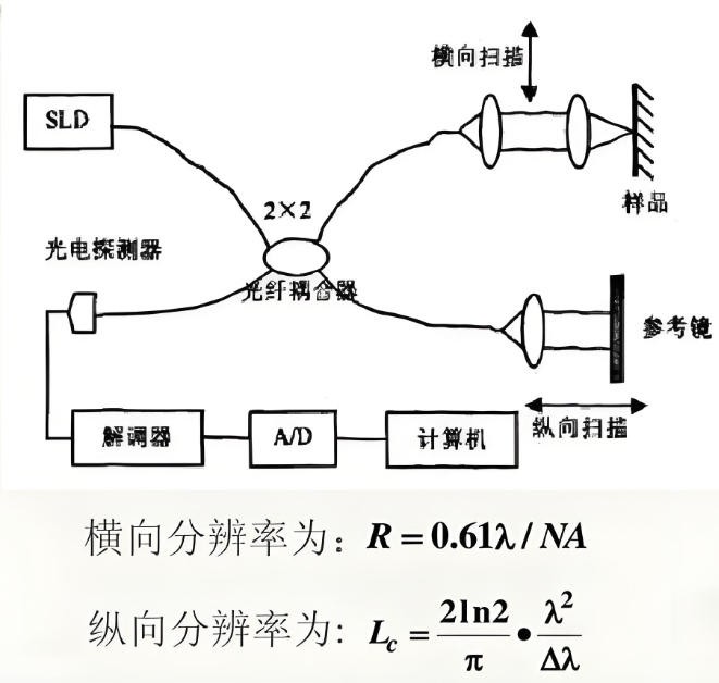 光学相干断层扫描 光学相干断层扫描